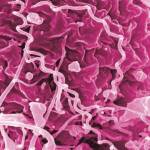 This image shows treponema pallidum, the bacteria that cause syphilis. (Courtesy Photo / NIAID)