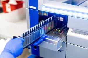 A lab scientist processes upper respiratory samples from patients suspected of having COVID-19 at the Stanford Clinical Virology Laboratory on Wednesday, Feb. 3, 2021, in Palo Alto, Calif. Two new cases were confirmed in Juneau School District on Feb. 4, 2021, prompting quarantines of possible contacts. (AP Photo / Noah Berger)