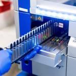 A lab scientist processes upper respiratory samples from patients suspected of having COVID-19 at the Stanford Clinical Virology Laboratory on Wednesday, Feb. 3, 2021, in Palo Alto, Calif. Two new COVID-19 cases were confirmed in Juneau School District on Feb. 4, 2021, prompting quarantines of possible contacts and a flurry of testing. (AP Photo / Noah Berger)