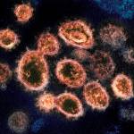 This 2020 electron microscope image provided by the National Institute of Allergy and Infectious Diseases - Rocky Mountain Laboratories shows SARS-CoV-2 virus particles which cause COVID-19, isolated from a patient in the U.S., emerging from the surface of cells cultured in a lab. Viruses are constantly mutating, with coronavirus variants circulating around the globe. (NIAID-RML)