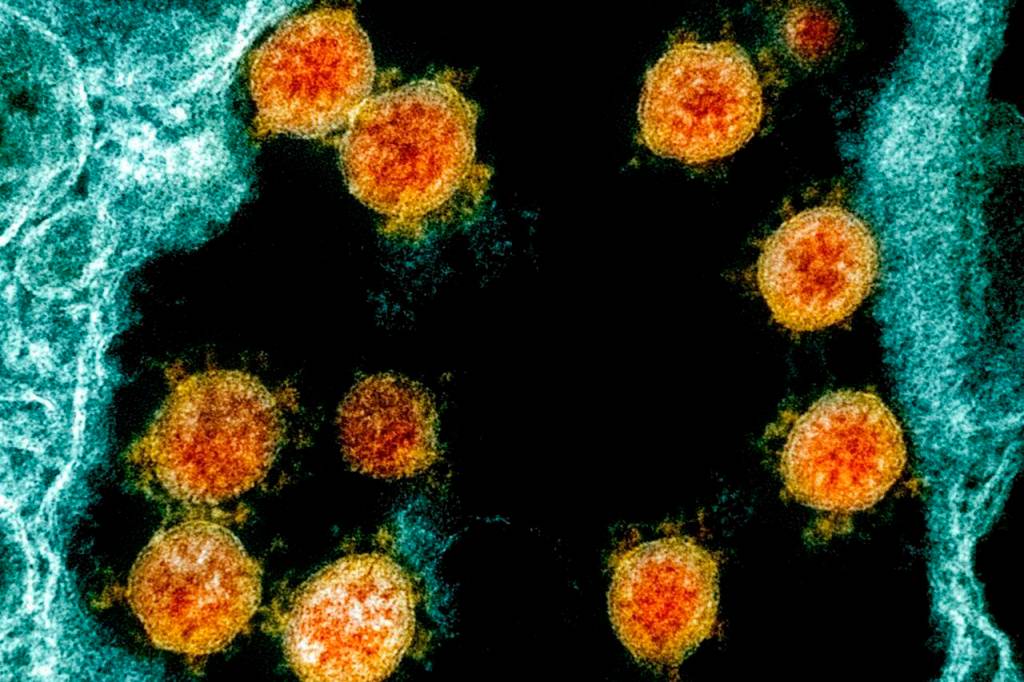 This electron microscope image made available and color-enhanced by the National Institute of Allergy and Infectious Diseases Integrated Research Facility in Fort Detrick, Md., shows Novel Coronavirus SARS-CoV-2 virus particles, orange, isolated from a patient. Putting an end to the COVID-19 pandemic will mean priming the immune systems of everyone on Earth but the virus is mutating and could take years to "settle down," says an expert. THE CANADIAN PRESS/AP-NIAID/National Institutes of Health