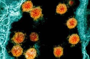This electron microscope image made available and color-enhanced by the National Institute of Allergy and Infectious Diseases Integrated Research Facility in Fort Detrick, Md., shows Novel Coronavirus SARS-CoV-2 virus particles, orange, isolated from a patient. Putting an end to the COVID-19 pandemic will mean priming the immune systems of everyone on Earth but the virus is mutating and could take years to "settle down," says an expert. THE CANADIAN PRESS/AP-NIAID/National Institutes of Health
