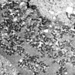 This undated electron microscope image made available by the Centers for Disease Control and Prevention shows rabies virions, dark and bullet-shaped, within an infected tissue sample. (F. A. Murphy/CDC via AP)