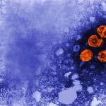 Hepatitis B virus particles, in orange, are seen in this microscopic image captured in 1981. Since so many people are unaware that they are infected, state health officials recommend stepped-up screening. (Photo by Dr. Erskin Palmer/U.S. Centers for Disease Control and Prevention)